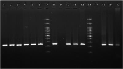 Molecular and microscopy detection of Pneumocystis jirovecii in hospitalized patients during the COVID-19 pandemic